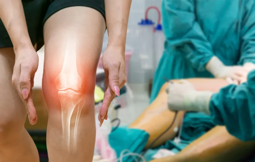 arthroscopic surgeries, arthroscopic knee surgery in indore, cartilage surgery in indore, orthopedic doctor in indore